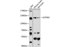 Western blot analysis of extracts of various cell lines, using SLITRK6 antibody (ABIN6130698, ABIN6148072, ABIN6148073 and ABIN6220277) at 1:1000 dilution. (SLITRK6 抗体  (AA 621-816))