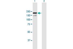 Western Blot analysis of SCAPER expression in transfected 293T cell line by SCAPER MaxPab polyclonal antibody. (SCAPER 抗体  (AA 1-1399))