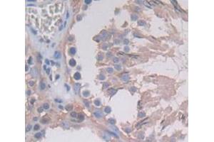 Used in DAB staining on fromalin fixed paraffin- embedded Kidney tissue (TUBE1 抗体  (AA 225-472))