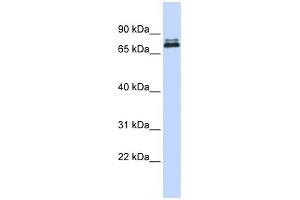 WB Suggested Anti-ASH2L Antibody Titration:  0. (ASH2L 抗体  (Middle Region))
