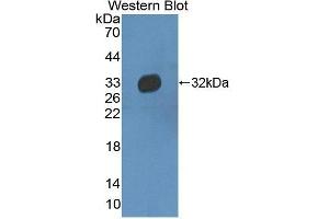 Western Blotting (WB) image for anti-Haptoglobin Related Protein (HPR) (AA 102-347) antibody (ABIN3205656) (HPR 抗体  (AA 102-347))