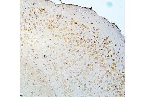 IHC analysis of DCC using anti-DCC antibody (ABIN7602566).