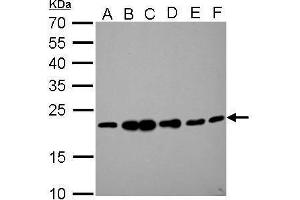 WB Image RAMP2 antibody detects RAMP2 protein by Western blot analysis.