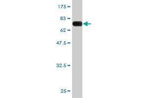 Western Blot detection against Immunogen (65. (PCBP2 抗体  (AA 1-362))