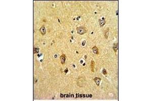 Formalin-fixed and paraffin-embedded human brain tissue with P2R2B Antibody (Center), which was peroxidase-conjugated to the secondary antibody, followed by DAB staining.