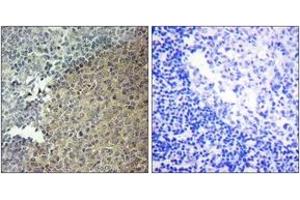 Immunohistochemistry analysis of paraffin-embedded human tonsil tissue, using BLNK (Ab-96) Antibody. (B-Cell Linker 抗体  (AA 62-111))
