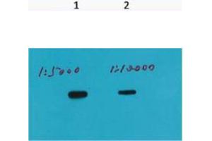 Western Blot (WB) analysis of Recombinant protein, (Q72) diluted at 1) 1:5000, 2) 1:10000. (HSV Tag 抗体)
