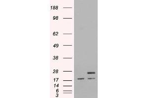 HEK293 overexpressing Human PGRMC1 and probed with ABIN2564496 (mock transfection in first lane). (PGRMC1 抗体  (C-Term))