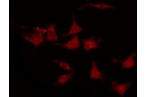 Immunofluorescence (fixed cells) (IF/ICC) image for anti-Receptor tyrosine-protein kinase erbB-2 (ErbB2/Her2) (pTyr877) antibody (ABIN6256054)