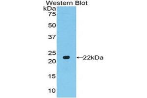 Western Blotting (WB) image for anti-POTE Ankyrin Domain Family, Member G (POTEG) (AA 146-306) antibody (ABIN1171743) (POTEG 抗体  (AA 146-306))