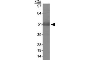 Western blot analysis of MSR1 in human liver using MSR1 polyclonal antibody . (Macrophage Scavenger Receptor 1 抗体  (AA 300-400))