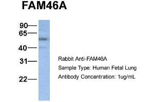 Host:  Rabbit  Target Name:  FAM46A  Sample Type:  Human Fetal Lung  Antibody Dilution:  1. (FAM46A 抗体  (N-Term))