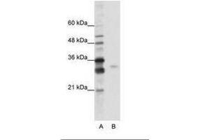 Image no. 1 for anti-serine/arginine-Rich Splicing Factor 1 (SRSF1) (AA 161-210) antibody (ABIN6736207) (SRSF1 抗体  (AA 161-210))