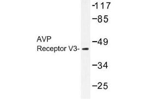 Image no. 1 for anti-Arginine Vasopressin Receptor 1B (AVPR1B) antibody (ABIN317776) (AVPR1B 抗体)