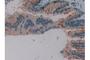 Immunohistochemistry (IHC) image for anti-Synuclein, gamma (Breast Cancer-Specific Protein 1) (SNCG) (AA 1-123) antibody (ABIN7429346)