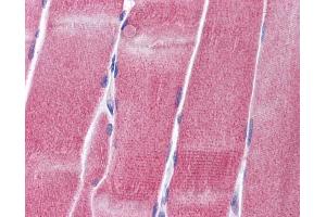 Immunohistochemistry (IHC) image for anti-Potassium Voltage-Gated Channel, Shaw-Related Subfamily, Member 4 (KCNC4) (Middle Region) antibody (ABIN2776170)