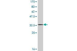 Western Blot detection against Immunogen (35. (TWIST2 抗体  (AA 54-140))