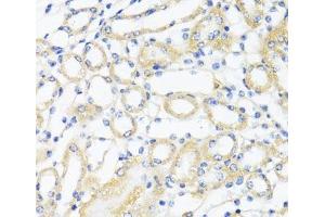 Immunohistochemistry of paraffin-embedded Mouse kidney using CTGF Polyclonal Antibody at dilution of 1:100 (40x lens). (CTGF 抗体)