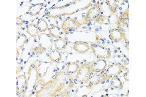 Immunohistochemistry of paraffin-embedded Mouse kidney using CTGF Polyclonal Antibody at dilution of 1:100 (40x lens).