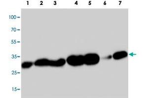 Western blot analysis of tissue extracts with PDPN polyclonal antibody . (Podoplanin 抗体  (C-Term))