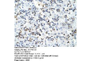 Rabbit Anti-PRMT2 Antibody  Paraffin Embedded Tissue: Human Liver Cellular Data: Liver cells Antibody Concentration: 4. (PRMT2 抗体  (N-Term))