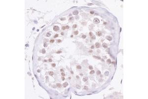 Immunohistochemistry (IHC) image for anti-Nuclear Receptor Coactivator 2 (NCOA2) (C-Term) antibody (ABIN7454615) (NCOA2 抗体  (C-Term))