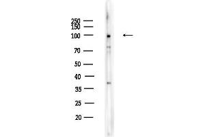 anti-Retinoblastoma Protein (Rb Protein) (pSer807) antibody