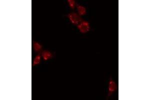 ABIN6277029 staining HuvEC by IF/ICC. (CD70 抗体  (Internal Region))
