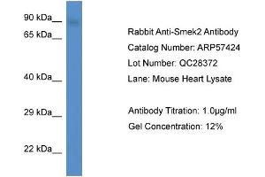 Western Blotting (WB) image for anti-SMEK Homolog 2, Suppressor of Mek1 (Dictyostelium) (SMEK2) (C-Term) antibody (ABIN785891) (SMEK2 抗体  (C-Term))