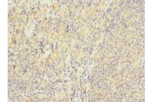 Immunohistochemistry of paraffin-embedded human tonsil tissue using ABIN7175617 at dilution of 1:100 (HVCN1 抗体  (AA 1-100))