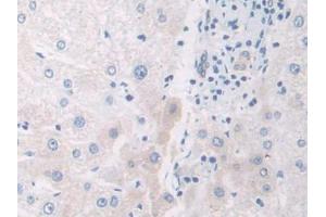 IHC-P analysis of Human Liver Tissue, with DAB staining. (IL12A 抗体  (AA 23-219))
