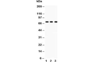 Western blot testing of p73 antibody and Lane 1:  COLO320;  2: MCF-7;  3: HeLa lysate (Tumor Protein p73 抗体  (AA 1-198))