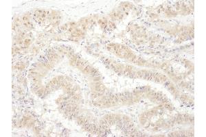 anti-Proteasome (Prosome, Macropain) 26S Subunit, ATPase, 4 (PSMC4) (AA 368-418) antibody