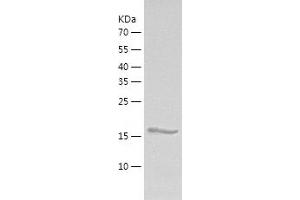 Western Blotting (WB) image for Ubiquitin-Conjugating Enzyme E2D 2 (UBE2D2) (AA 1-147) protein (His tag) (ABIN7125610) (UBE2D2 Protein (AA 1-147) (His tag))