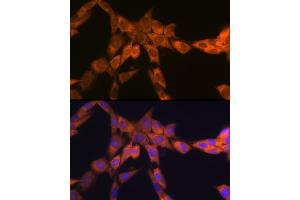 Immunofluorescence analysis of NIH-3T3 cells using 67 kDa Laminin Receptor Rabbit mAb (ABIN7270042) at dilution of 1:100 (40x lens). (RPSA/Laminin Receptor 抗体)