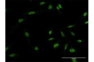 Immunofluorescence of monoclonal antibody to MYNN on HeLa cell. (Myoneurin 抗体  (AA 501-610))