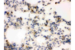 IHC analysis of Lipocalin 2 using anti-Lipocalin 2 antibody . (Lipocalin 2 抗体  (AA 21-200))