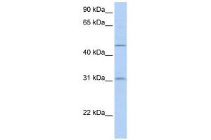 SLC39A11 antibody used at 1 ug/ml to detect target protein. (SLC39A11 抗体)