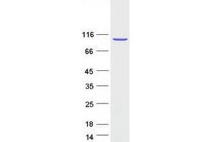Validation with Western Blot