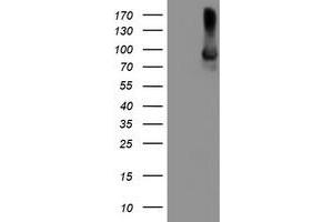 HEK293T cells were transfected with the pCMV6-ENTRY control (Left lane) or pCMV6-ENTRY ALOX15 (Right lane) cDNA for 48 hrs and lysed. (ALOX15 抗体)