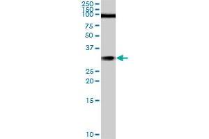 TGIF2 monoclonal antibody (M02), clone 5B11. (TGIF2 抗体  (AA 131-236))