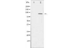 Western blot analysis of PKC alpha phosphorylation expression in UV treated NIH-3T3 whole cell lysates,The lane on the left is treated with the antigen-specific peptide. (PKC alpha 抗体  (pThr638))