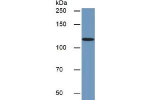 Rabbit Detection antibody from the kit in WB with Positive Control:  Sample Human Jurkat lysate. (CD31 ELISA 试剂盒)