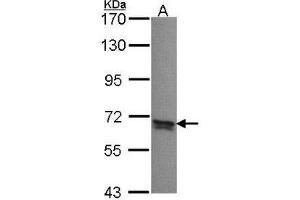 Western Blot analysis: PPP2R5B antibody staining of A431 whole cell lysate (30 µg) at 1/1000 dilution, 7. (PPP2R5B 抗体  (C-Term))