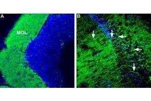 Expression of Corticotropin-releasing factor receptor 1 in mouse brain - Immunohistochemical staining of mouse hippocampus and mouse cerebellum using Anti-CRF1/CRHR1 (extracellular) Antibody (ABIN7043086, ABIN7044185 and ABIN7044186), (1:600). (CRHR1 抗体  (Extracellular))