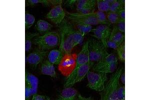 Immunofluorescence staining of methanol-fixed Hela using NFkB-p65(Phospho-Thr254) Antibody. (NF-kB p65 抗体  (pThr254))