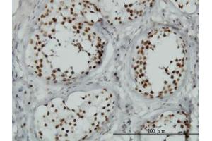 Image no. 1 for anti-Tousled-Like Kinase 1 (TLK1) (AA 111-230) antibody (ABIN599099) (TLK1 抗体  (AA 111-230))