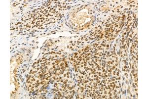 ABIN7094346 and ABIN7098393 at 1/100 staining Rat ovary tissue by IHC-P. (MACC1 抗体  (N-Term))