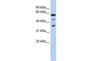 Image no. 1 for anti-RD RNA Binding Protein (RDBP) (AA 35-84) antibody (ABIN6742975) (RDBP 抗体  (AA 35-84))