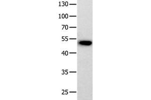 Gel: 10 % SDS-PAGE Lysate: 40 μg 823 cell Primary antibody: 1/200 dilution Secondary antibody dilution: 1/8000 Exposure time: 20 minutes (Prokineticin Receptor 2 抗体  (N-Term))